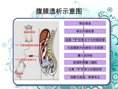 分子氢对腹膜透析患者超滤功能影响的临